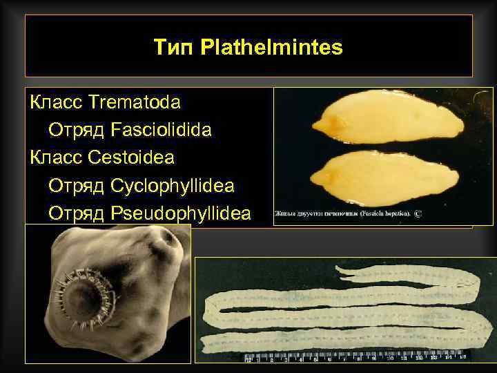 Тип Plathelmintes Класс Trematoda Отряд Fasciolidida Класс Cestoidea Отряд Cyclophyllidea Отряд Pseudophyllidea 
