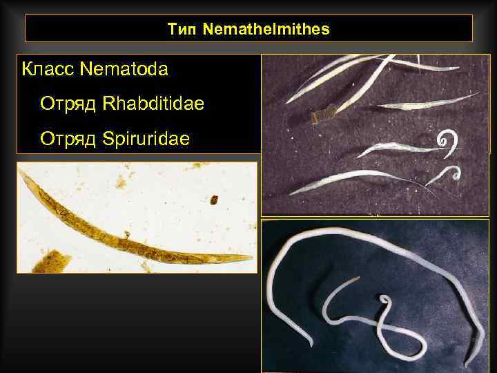 Тип Nemathelmithes Класс Nematoda Отряд Rhabditidae Отряд Spiruridae 