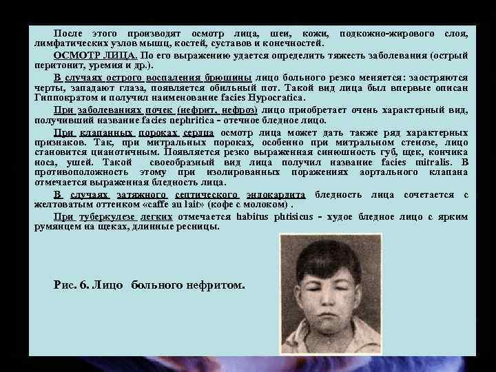 После этого производят осмотр лица, шеи, кожи, подкожно жирового слоя, лимфатических узлов мышц, костей,