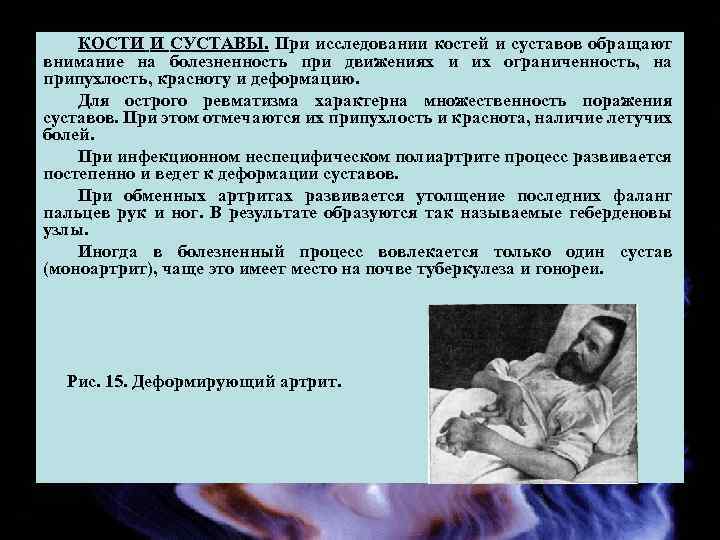 КОСТИ И СУСТАВЫ. При исследовании костей и суставов обращают внимание на болезненность при движениях