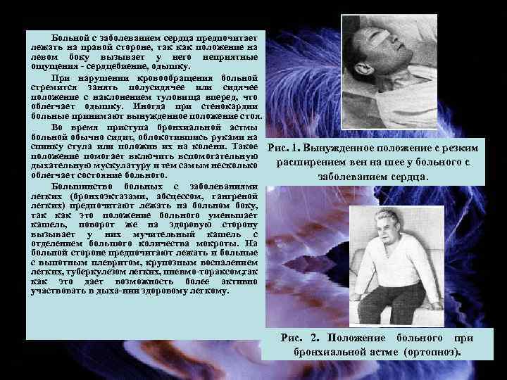 Больной с заболеванием сердца предпочитает лежать на правой стороне, так как положение на левом