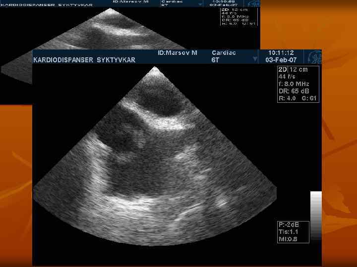 ЧП ЭХО-КГ 3. 02 