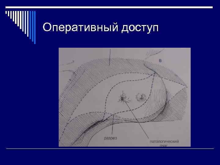 Оперативный доступ 