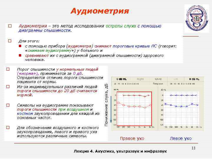 Аудиометрия – это метод исследования остроты слуха с помощью диаграммы слышимости. o Для этого: