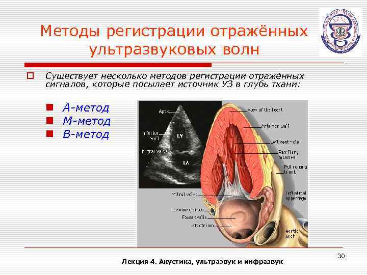 Методы регистрации отражённых ультразвуковых волн o Существует несколько методов регистрации отражённых сигналов, которые посылает