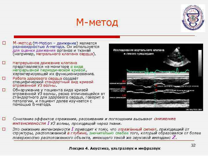 М-метод o М-метод (М-Motion – движение) является o Непрерывное движение клапана представляется на мониторе