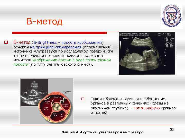 В-метод o В-метод (В-Brightness – яркость изображения) основан на принципе сканирования (перемещения) источника ультразвука