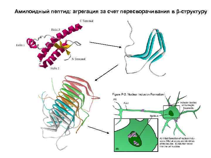 Амилоидный пептид: агрегация за счет пересворачивания в β-структуру 