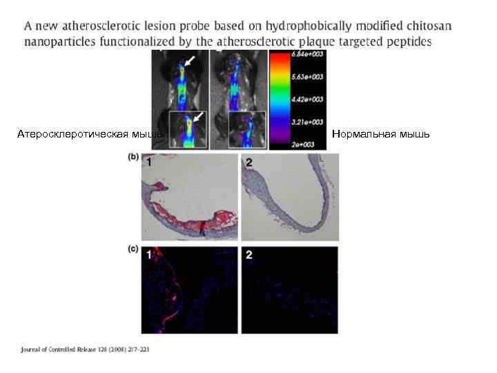 Атеросклеротическая мышь Нормальная мышь 