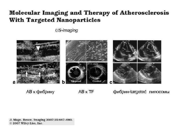 US-imaging AB к фибрину AB к TF фибрин-targeted липосомы 