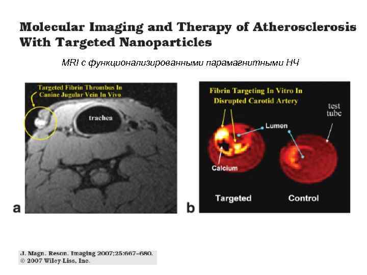 MRI с функционализированными парамагнитными НЧ 