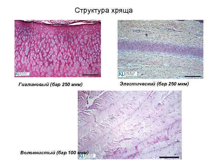 Волокнистый хрящ гистология