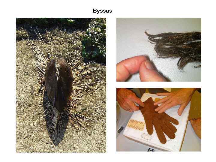 Byssus 