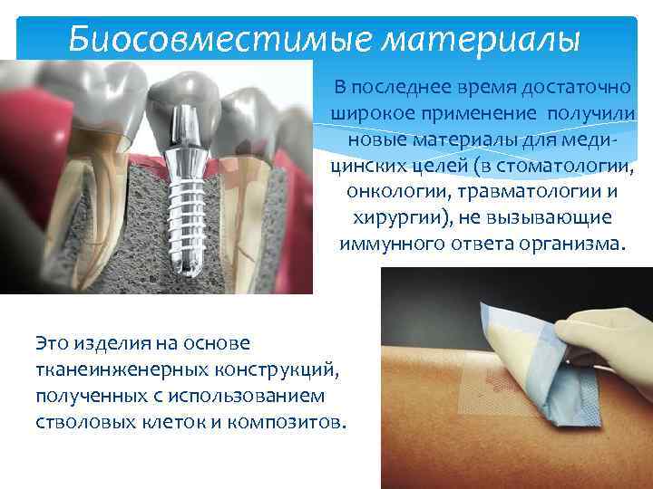 Биосовместимые материалы В последнее время достаточно широкое применение получили новые материалы для медицинских целей