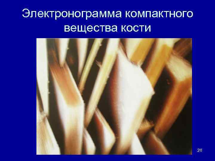 Электронограмма компактного вещества кости 26 