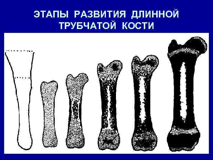 Тело длинные трубчатые кости