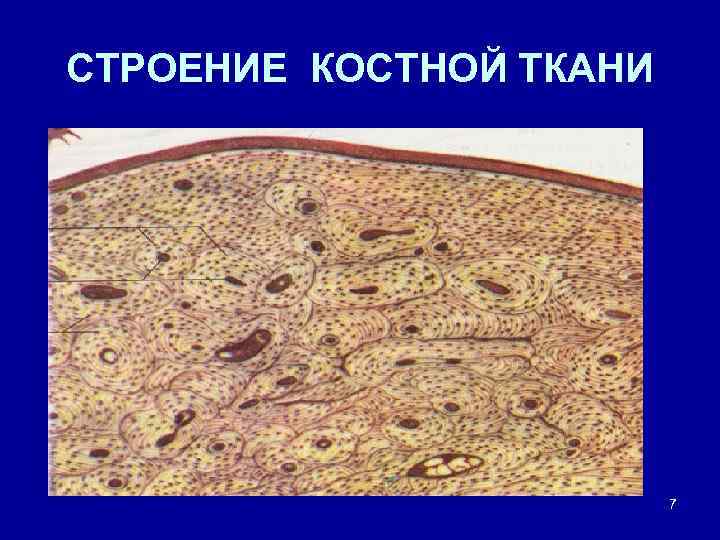 Костная ткань строение. Структура костной ткани. Костная ткань анатомия. Строение клетки кости. Опыты строение костной ткани.