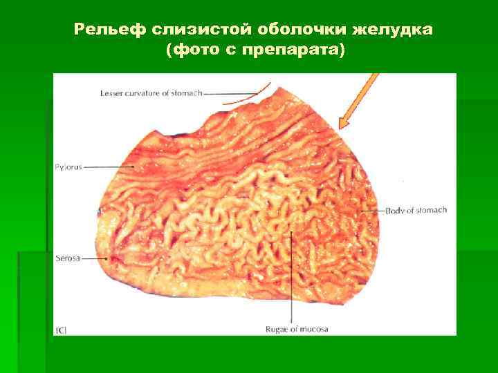 Слизистая оболочка желудка задние рога. Рельеф слизистой желудка. Особенности рельефа слизистой оболочки желудка. Слизистая оболочка желудка.