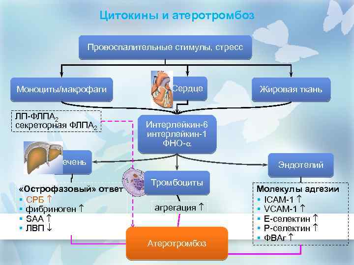 Цитокины и атеротромбоз Провоспалительные стимулы, стресс Моноциты/макрофаги ЛП-ФЛПА 2 секреторная ФЛПА 2 Сердце Интерлейкин-6