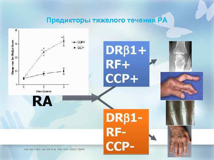 Предикторы тяжелого течения РА DR 1+ RF+ CCP+ RA Van der Helm, van Mil