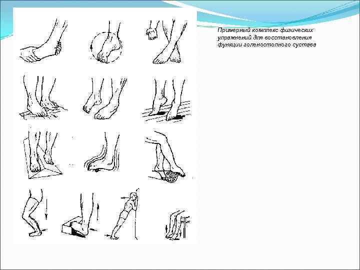Примерный комплекс физических упражнений для восстановления функции голеностопного сустава 