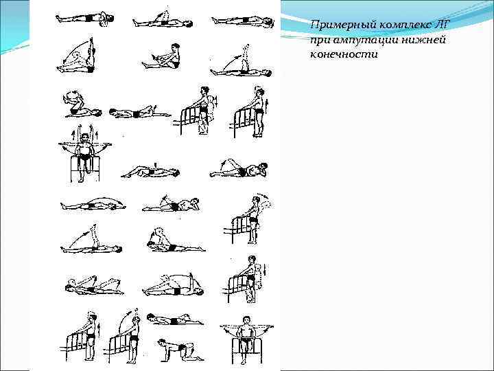 Примерный комплекс ЛГ при ампутации нижней конечности 