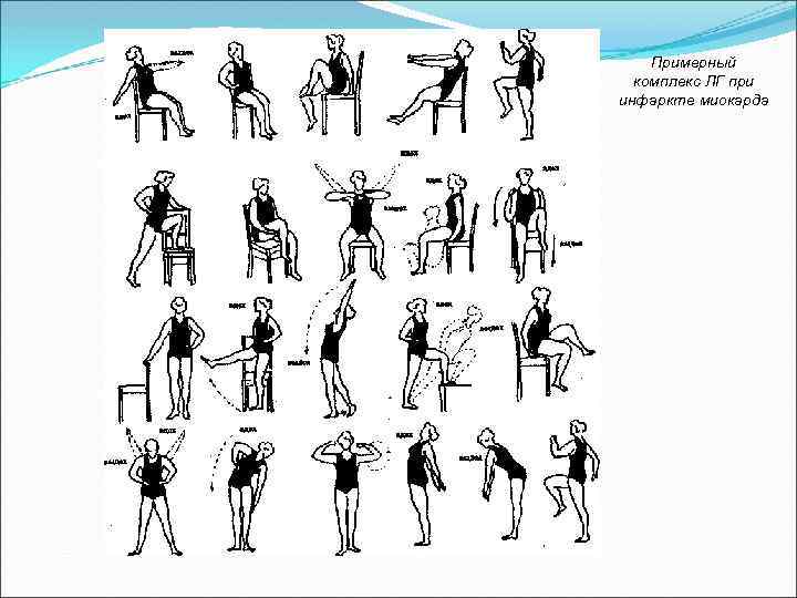 Примерный комплекс ЛГ при инфаркте миокарда 