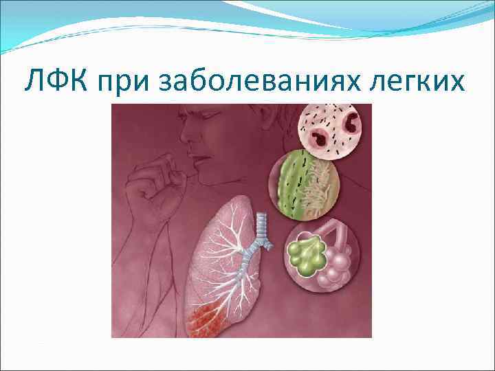 ЛФК при заболеваниях легких 