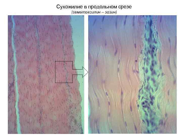 Сухожилие в продольном срезе (гематоксилин – эозин) 