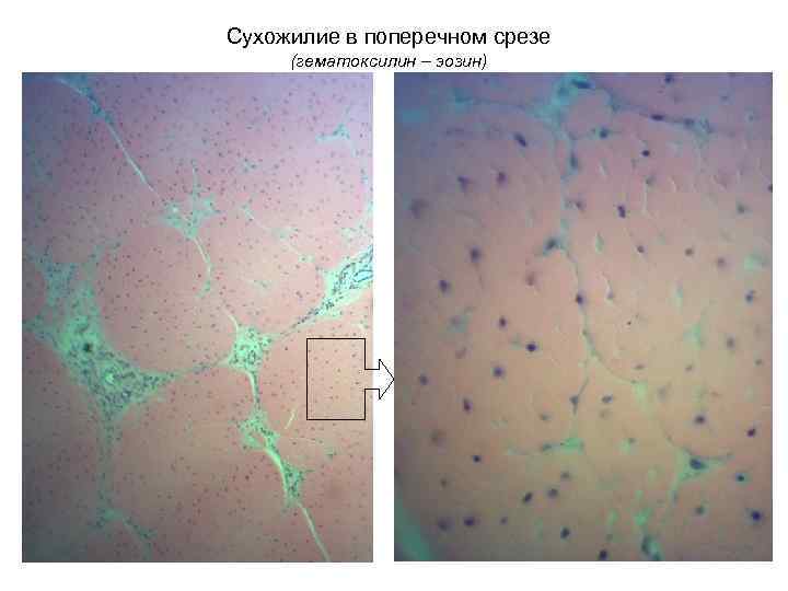 Сухожилие в поперечном срезе (гематоксилин – эозин) 