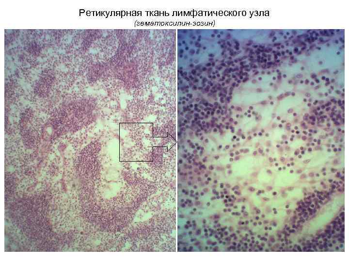 Ретикулярная ткань лимфатического узла (гематоксилин-эозин) 