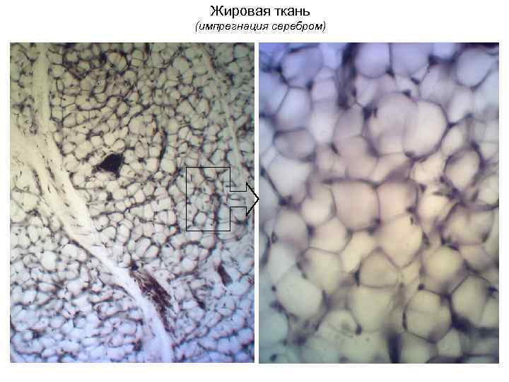 Жировая ткань (импрегнация серебром) 