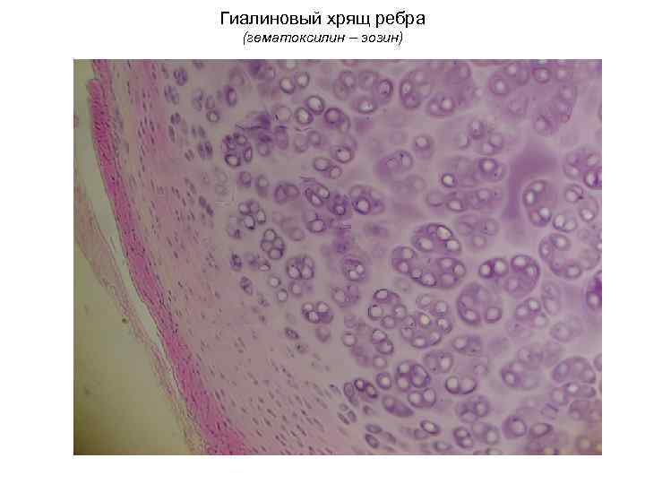 Гиалиновый хрящ ребра (гематоксилин – эозин) 