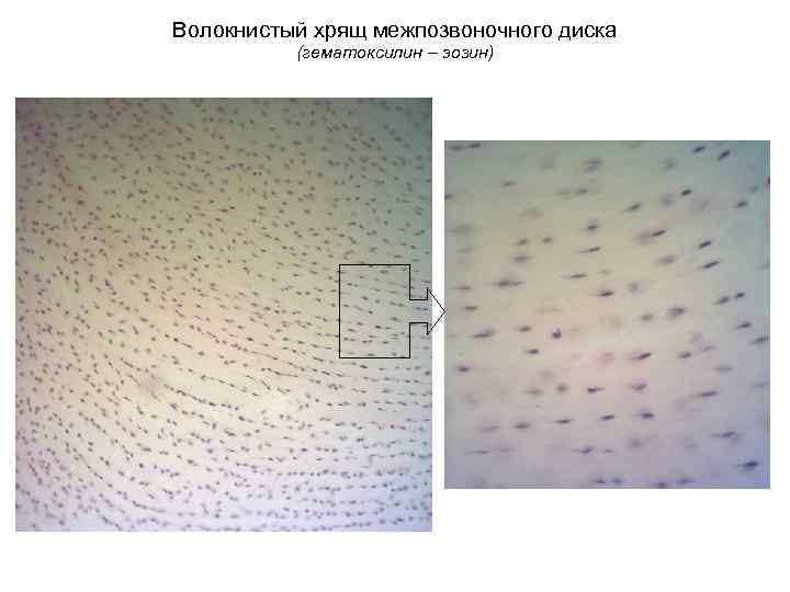 Волокнистый хрящ межпозвоночного диска (гематоксилин – эозин) 