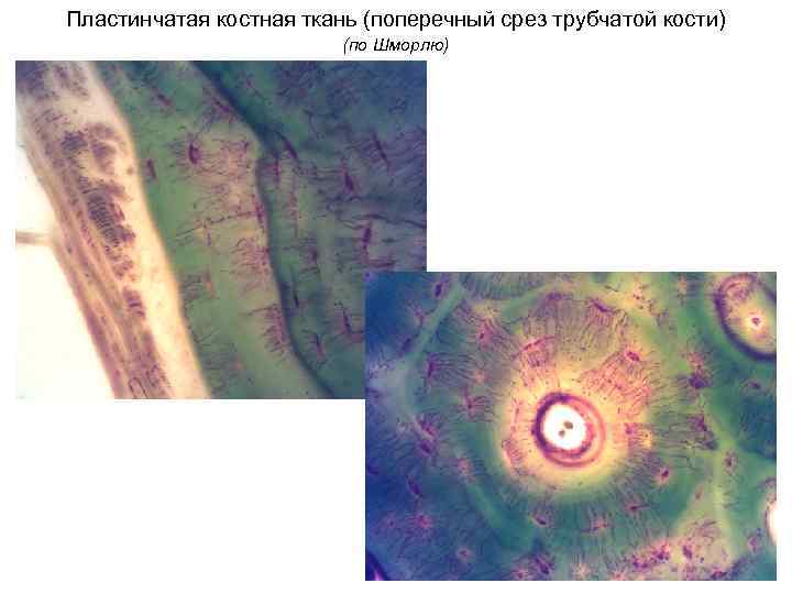 Пластинчатая костная ткань (поперечный срез трубчатой кости) (по Шморлю) 