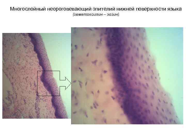 Многослойный неороговевающий эпителий нижней поверхности языка (гематоксилин – эозин) 