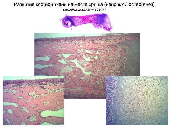 Развитие костной ткани на месте хряща (непрямой остеогенез) (гематоксилин – эозин) 