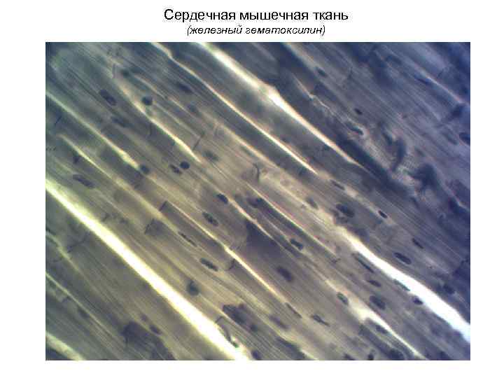 Сердечная мышечная ткань (железный гематоксилин) 