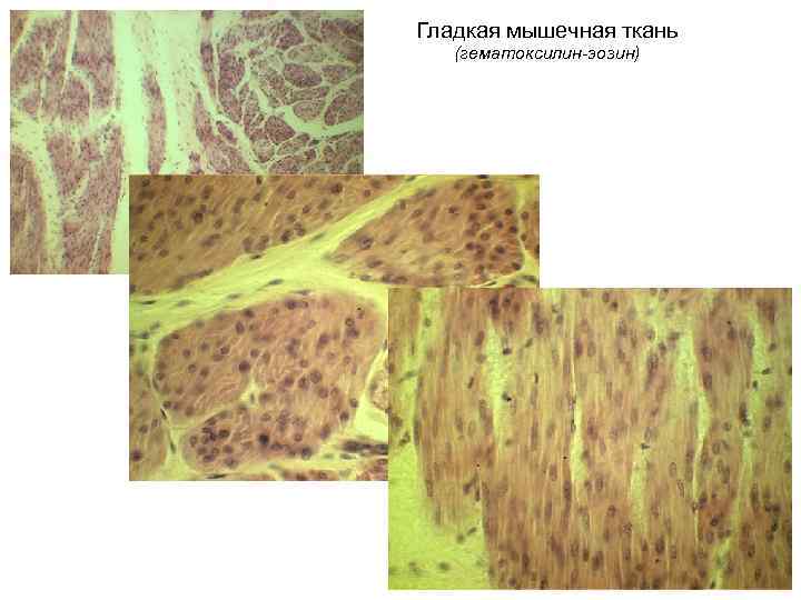 Гладкая мышечная ткань (гематоксилин-эозин) 