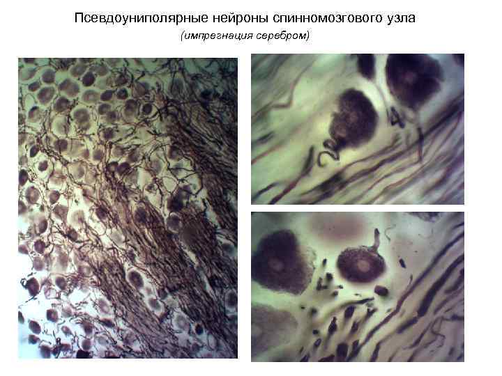 Псевдоуниполярные нейроны спинномозгового узла (импрегнация серебром) 