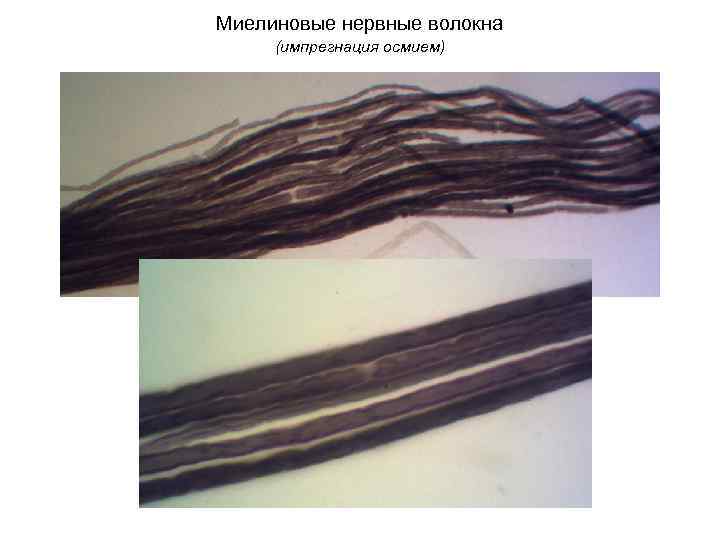 Миелиновые нервные волокна (импрегнация осмием) 