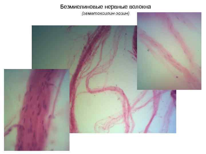 Безмиелиновые нервные волокна (гематоксилин-эозин) 