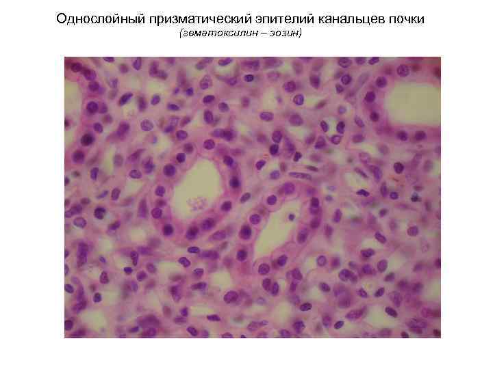 Однослойный призматический эпителий канальцев почки (гематоксилин – эозин) 