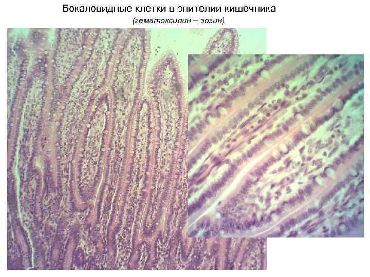 Бокаловидные клетки в эпителии кишечника (гематоксилин – эозин) 