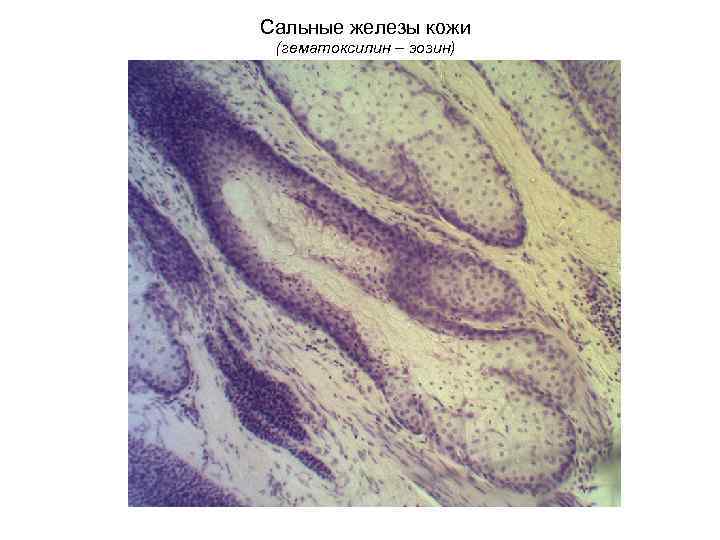 Сальные железы кожи (гематоксилин – эозин) 