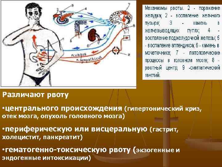 Различают рвоту • центрального происхождения (гипертонический криз, отек мозга, опухоль головного мозга) • периферическую