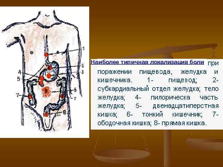 Дегтеобразный стул бывает при кровотечении