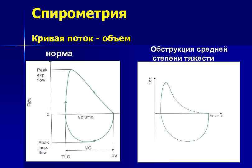 Спирометрия Кривая поток - объем норма Обструкция средней степени тяжести 