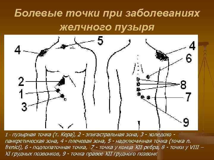 Болевые точки при заболеваниях желчного пузыря 1 - пузырная точка (т. Кера), 2 -