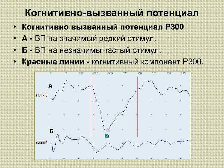 Когнитивно-вызванный потенциал • • Когнитивно вызванный потенциал Р 300 А - ВП на значимый